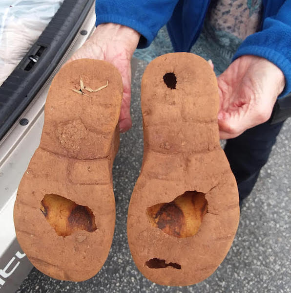 holes-in-skin-on-feet